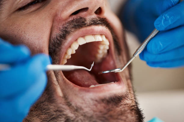 Best After-Hours Emergency Dentist in Vicksburg, MI