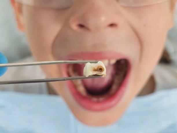 Best Emergency Dental Care for Trauma or Injury in Vicksburg, MI