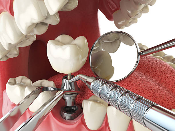 Best Emergency Dental Surgery in Vicksburg, MI